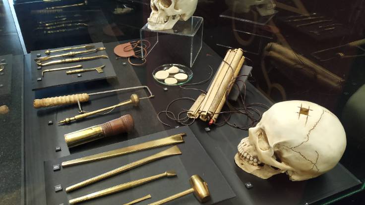 Una gran exposición en la Campa Torres reproduce el instrumental médico que utilizaban los romanos