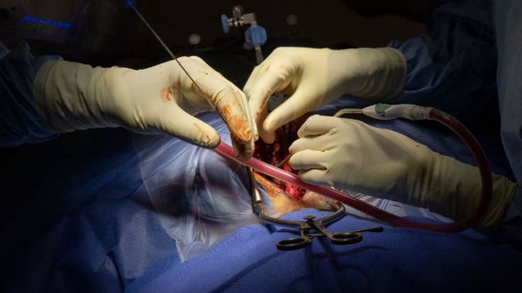 Fernando Pereira, jefe de Cirugía General y Aparato Digestivo del Hospital de Fuenlabrada, hace balance del primer año del nuevo tratamiento contra el cáncer de páncreas