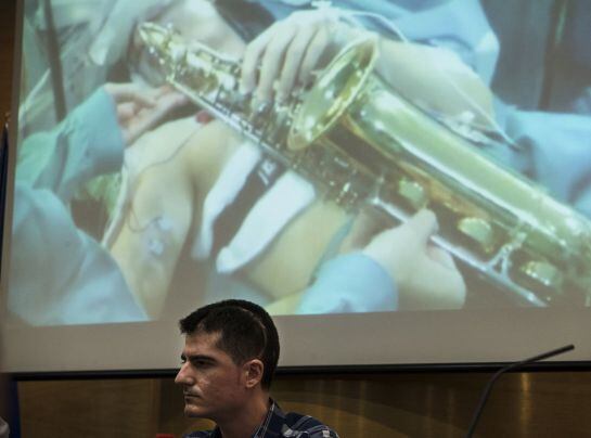 El músico de 27 años Carlos Aguilera frente a las imágenes de su intervención realizada el pasado 15 de octubre en el Hospital Regional de Málaga donde, por primera vez en Europa, se le extirpó un tumor en el que se realizó un mapa de la corteza cerebral del lenguaje musical mientras se mantuvo despierto en la operación y tocó el saxofón para evitar secuelas