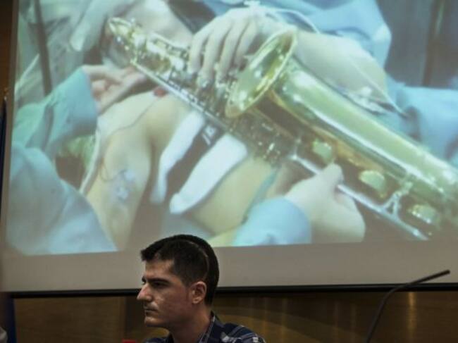 El músico de 27 años Carlos Aguilera frente a las imágenes de su intervención realizada el pasado 15 de octubre en el Hospital Regional de Málaga donde, por primera vez en Europa, se le extirpó un tumor en el que se realizó un mapa de la corteza cerebral del lenguaje musical mientras se mantuvo despierto en la operación y tocó el saxofón para evitar secuelas