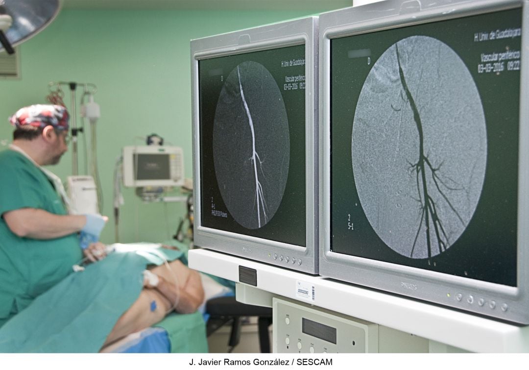 Intervención de cirugía vascular