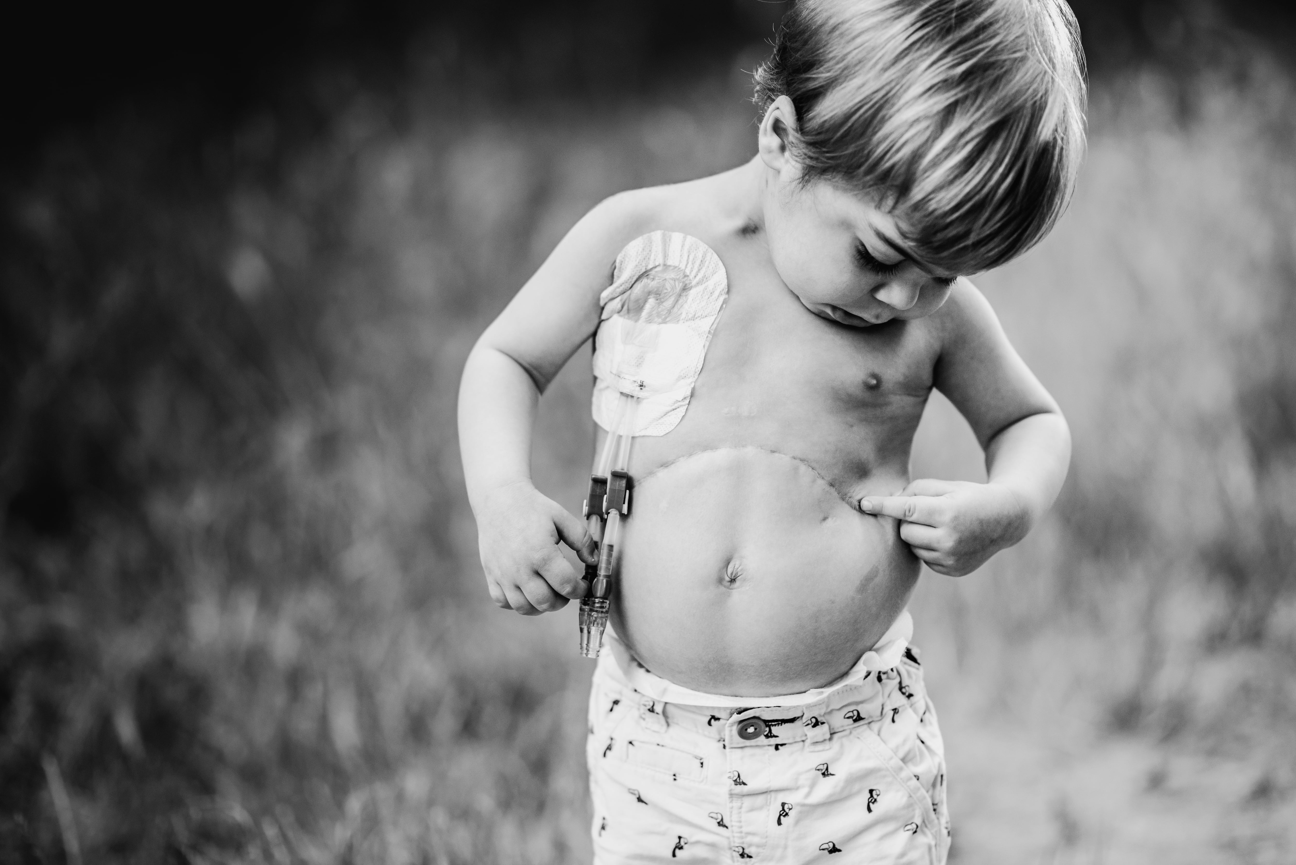 Fotografía de Mateo por Inma Ríos Escamilla a favor de la Fundación Ana Carolina Díez Mahou.