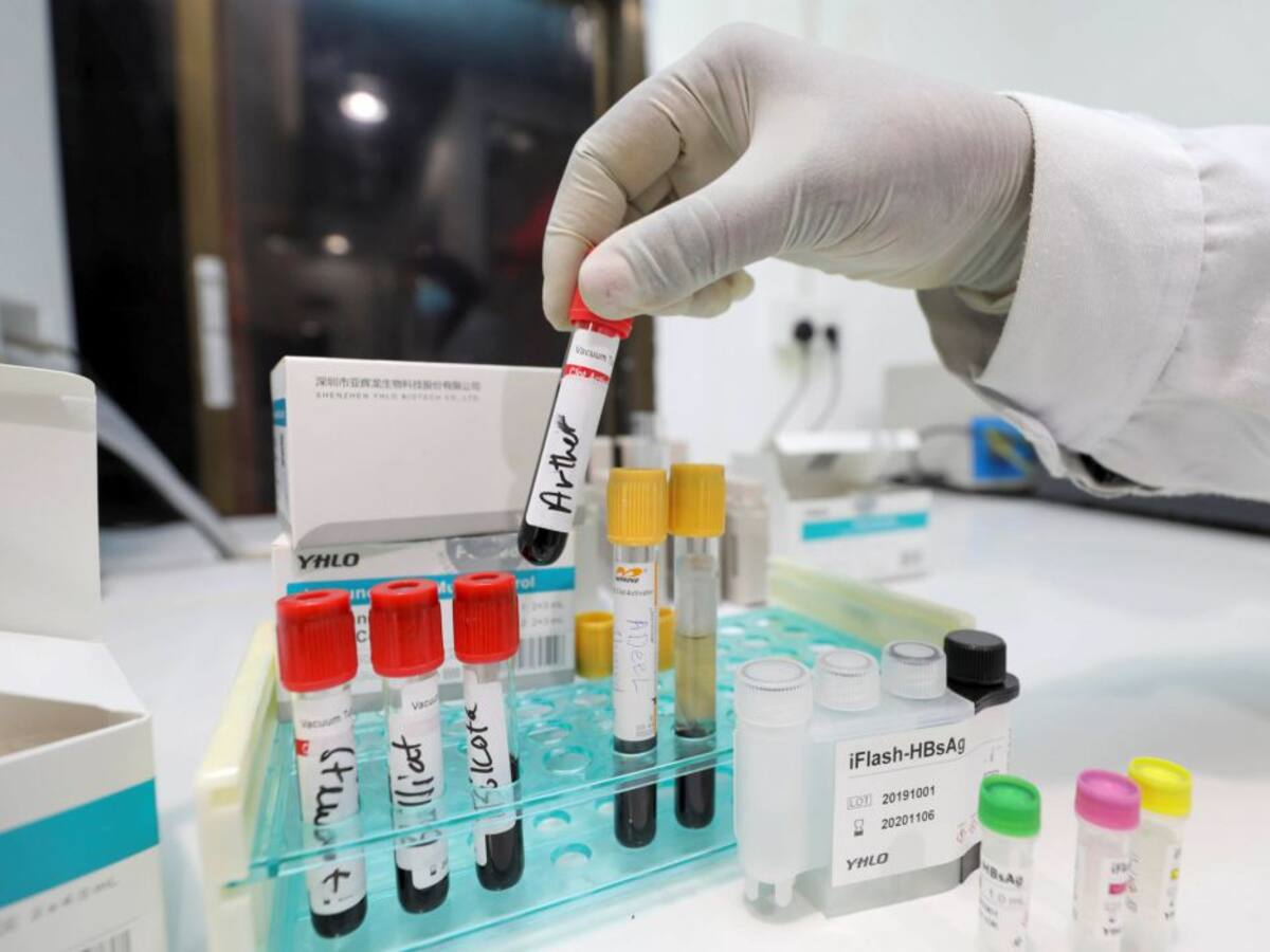 Así funciona el bamlanivimab, el primer medicamento específico contra la COVID-19