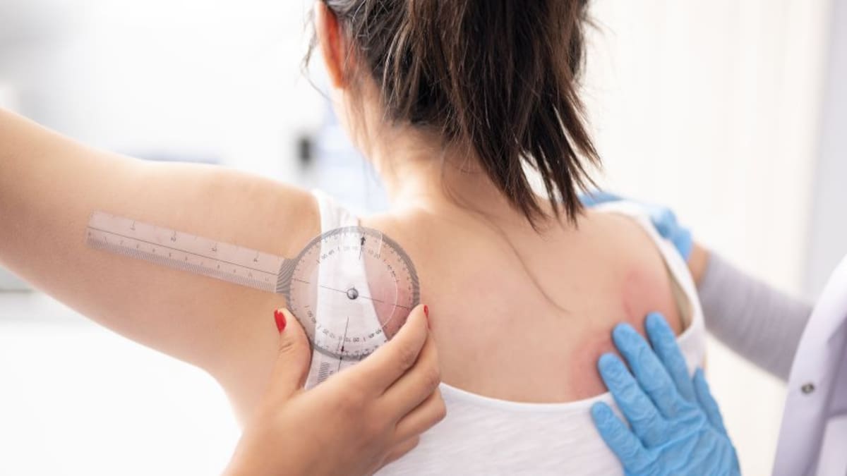 Biomarcadores para detección temprana de fibromialgia