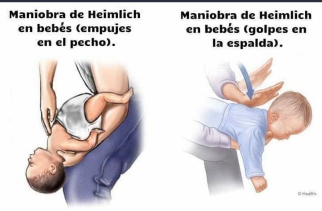 Tutorial práctico sobre cómo realizar la maniobra de Heimlich