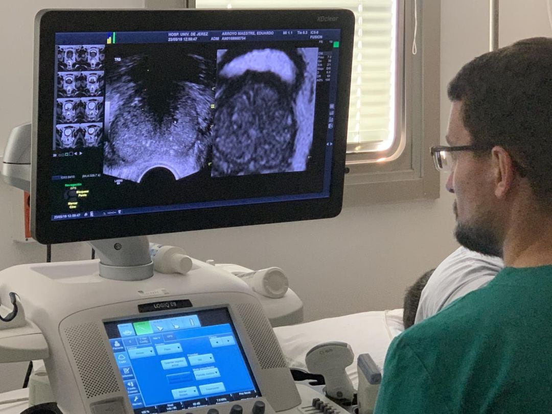 Ecógrafo del Servicio de Urología, en el Hospital Universitario de Jerez