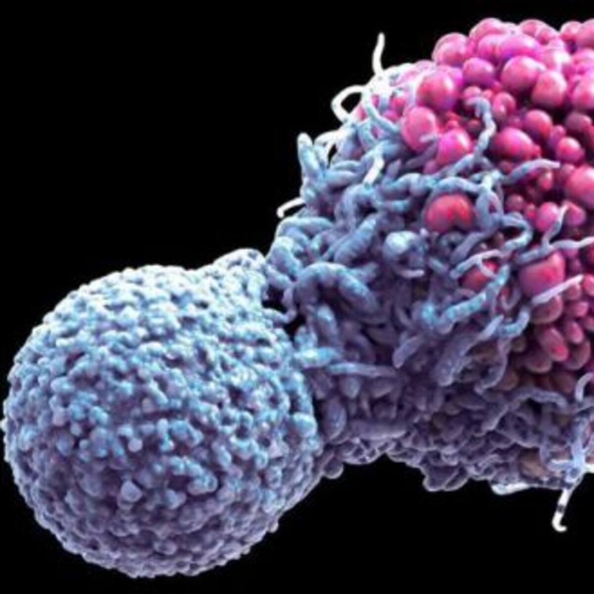 Una familia pide ayuda para investigar el rabdoide que padece su hijo de 17 meses, un cáncer muy agresivo y con escasa incidencia