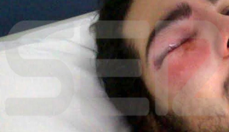 Imagen del rostro de Iñaki poco después del 22-M