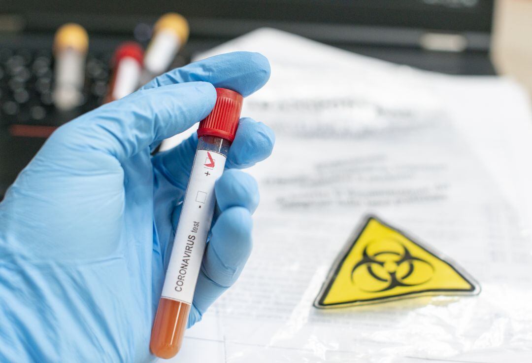 Nuevo récord de positivos en un día en la Región, 133 en las últimas 24 horas