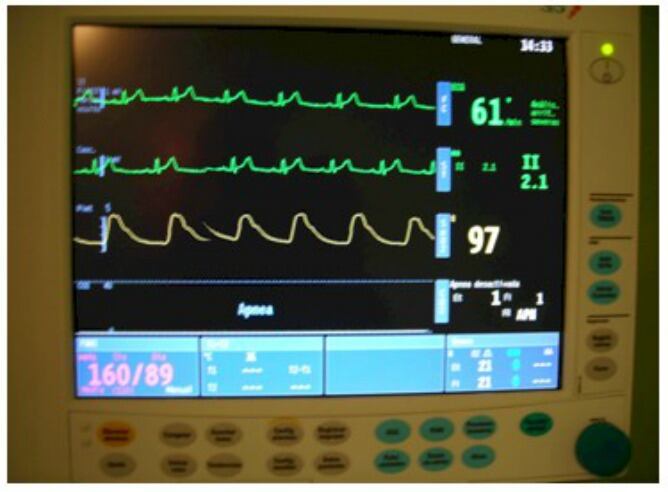 Equipo de monitorización del Hospital Universitario de Canarias