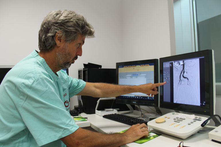 Nuevo tratamiento de Radioembolización en el Hospital del Vinalopó