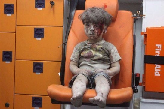 Omar Daqneesh, el niño sirio herido.