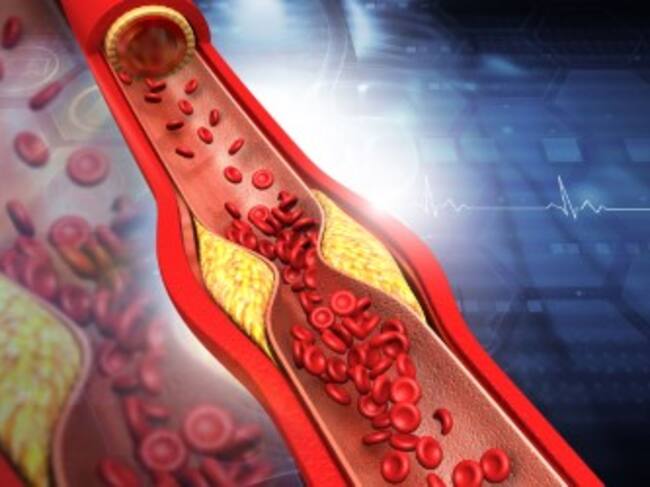 UPV/EHUko ikertzaile talde batek garatu du