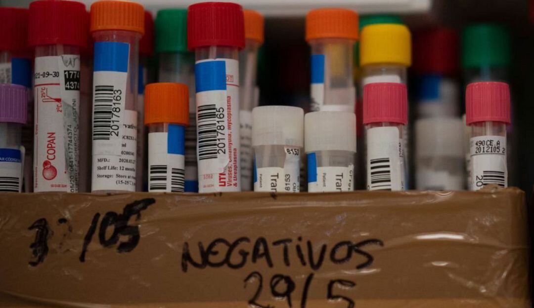 Análisis de test de coronavirus.