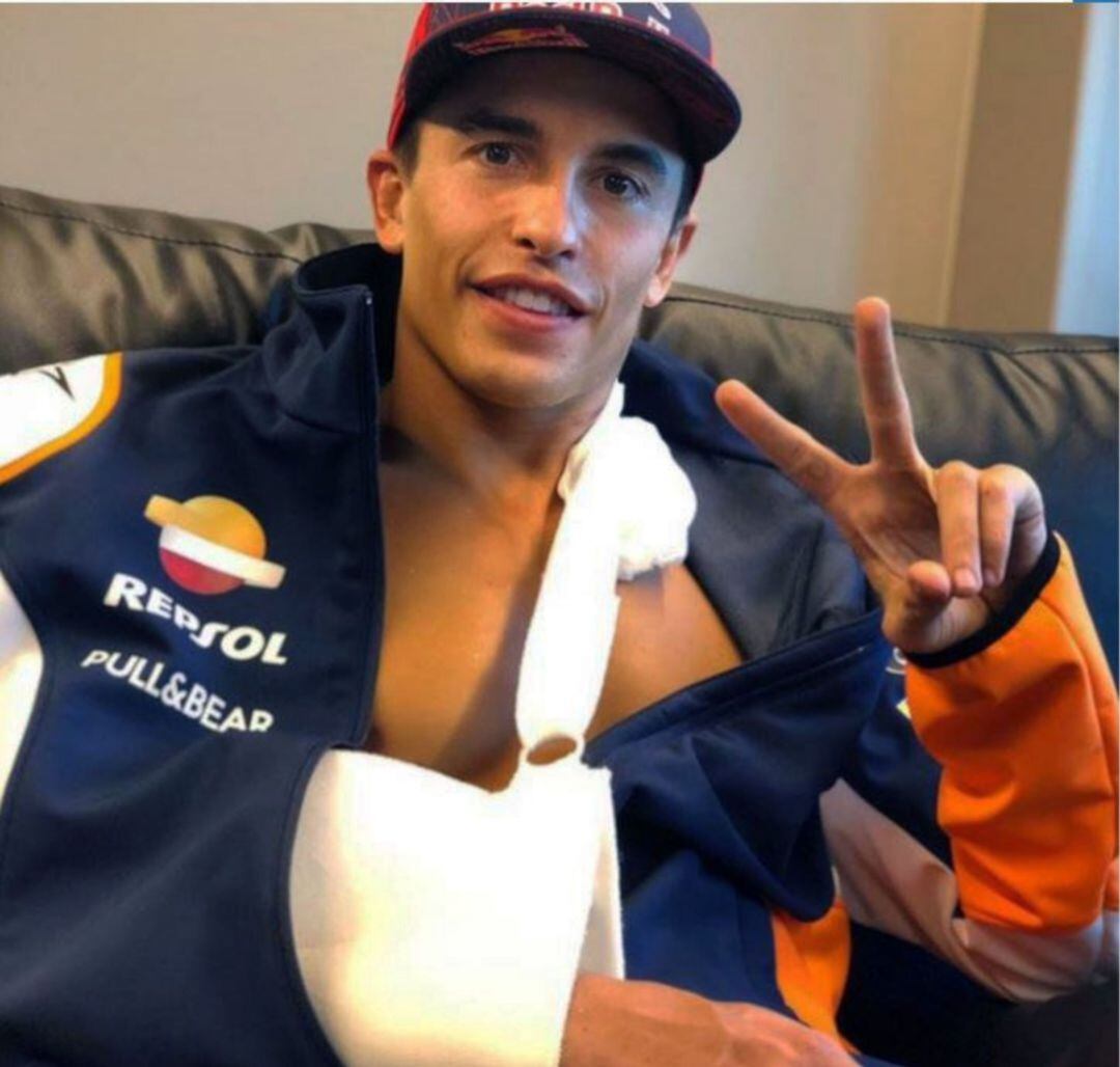 Marc Márquez será operado este martes