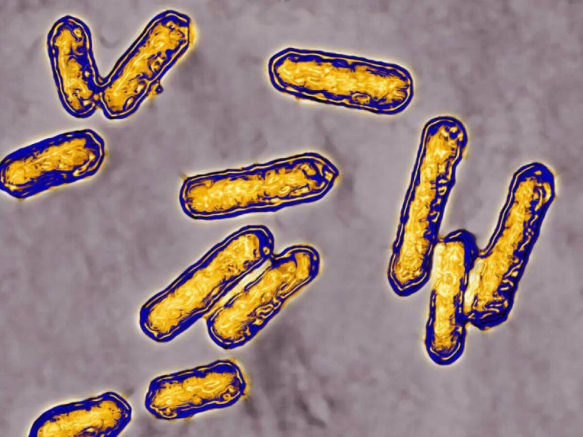 No era listeriosis