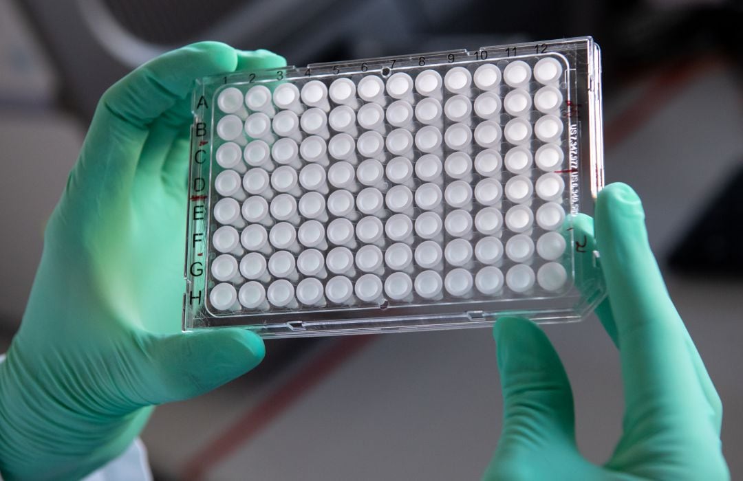 Varias muestras de PCR en un laboratorio. 