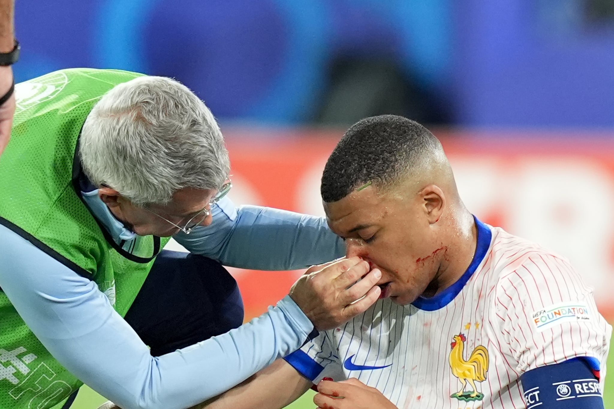 Los doctores de Francia exploran la nariz de Kylian Mbappé tras el golpe que sufrió en el partido ante Austria