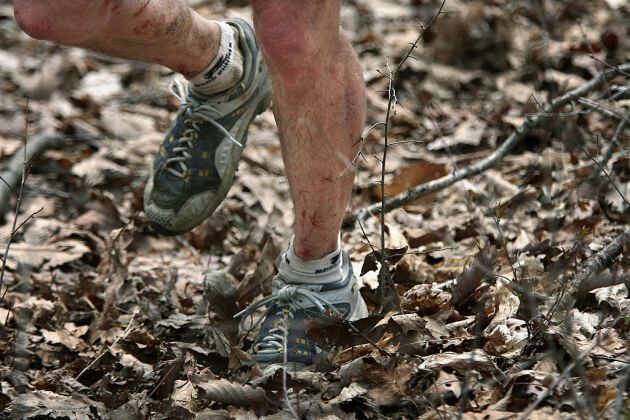 Las piernas del corredor Jim Nelson, en la Barkley de 2017, magulladas y arañadas por las espinas de los arbustos que se encontró en la competición