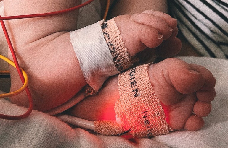 Los pies de la pequeña Marina durante su estancia en La Paz