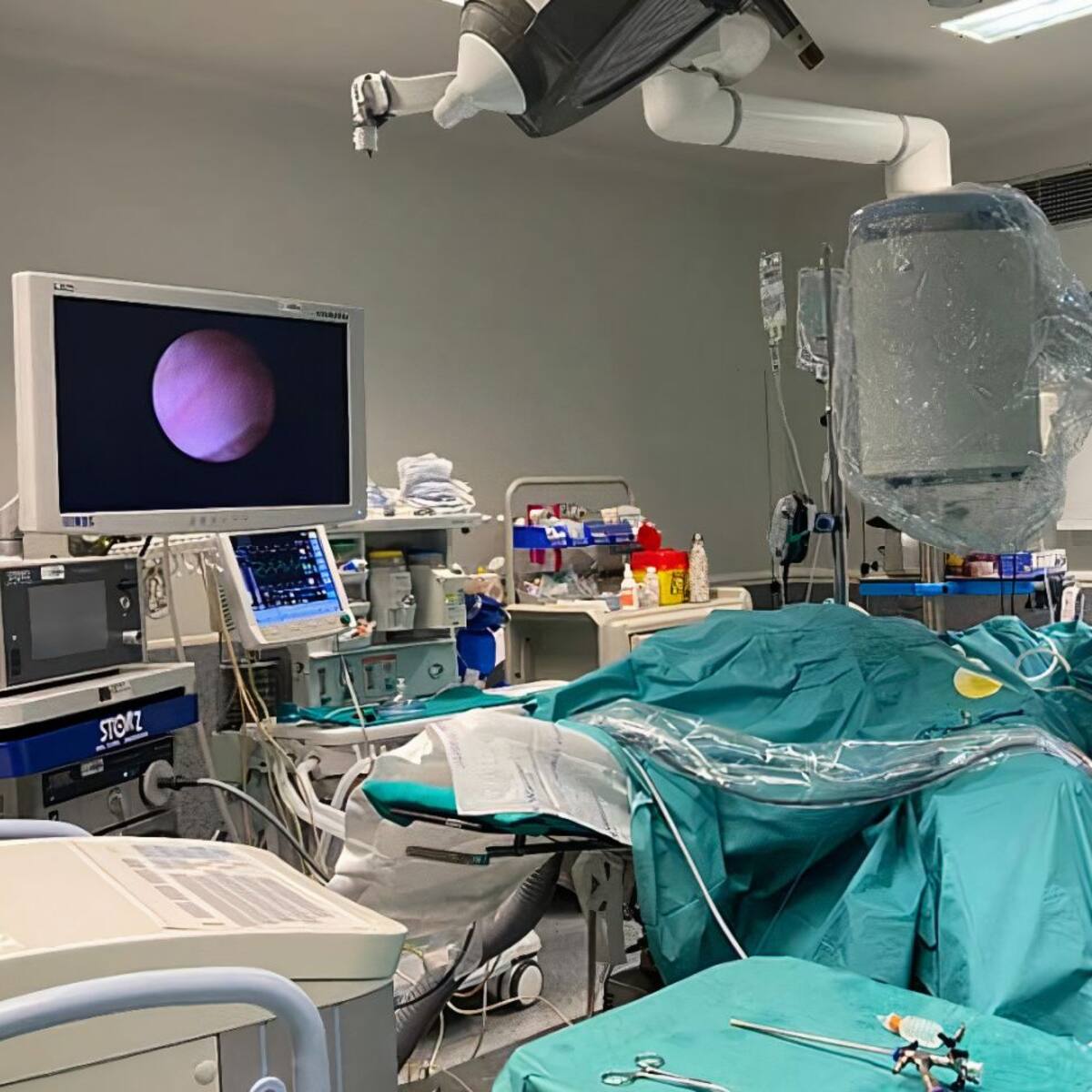 Cirujanos del Hospital de A Coruña usan por primera vez el robot Davinci en una extirpación de cáncer de páncreas