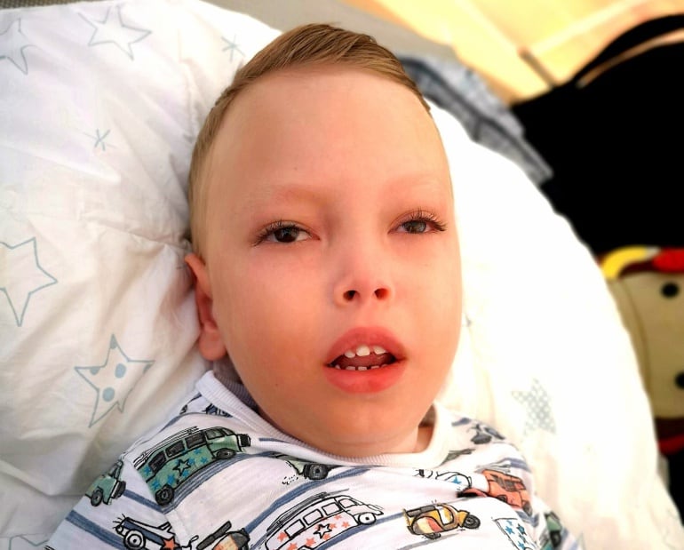 Liam ha luchado contra su enfermedad rara Tay-Sachs