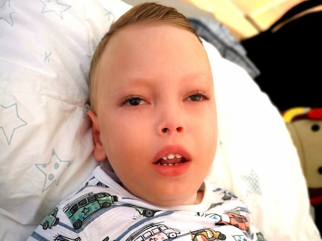 Liam ha luchado contra su enfermedad rara Tay-Sachs