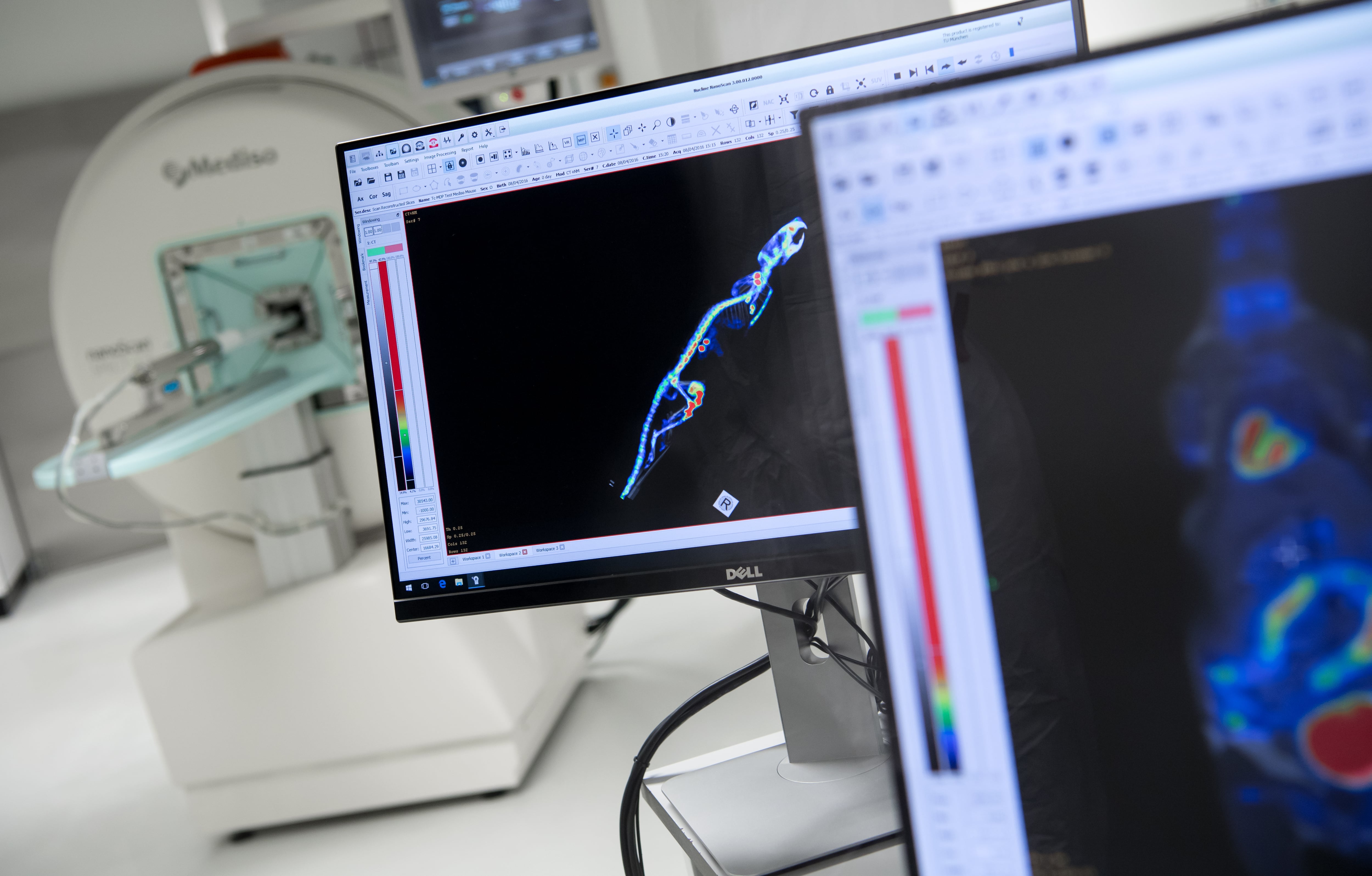 Imagen de un laboratorio de investigación del cáncer en Munich (Alemania).