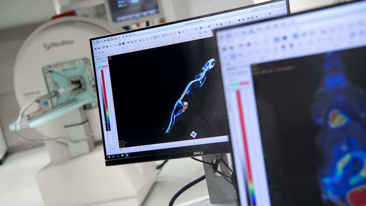 La AECC reclama al Gobierno central más inversión en la investigación del cáncer