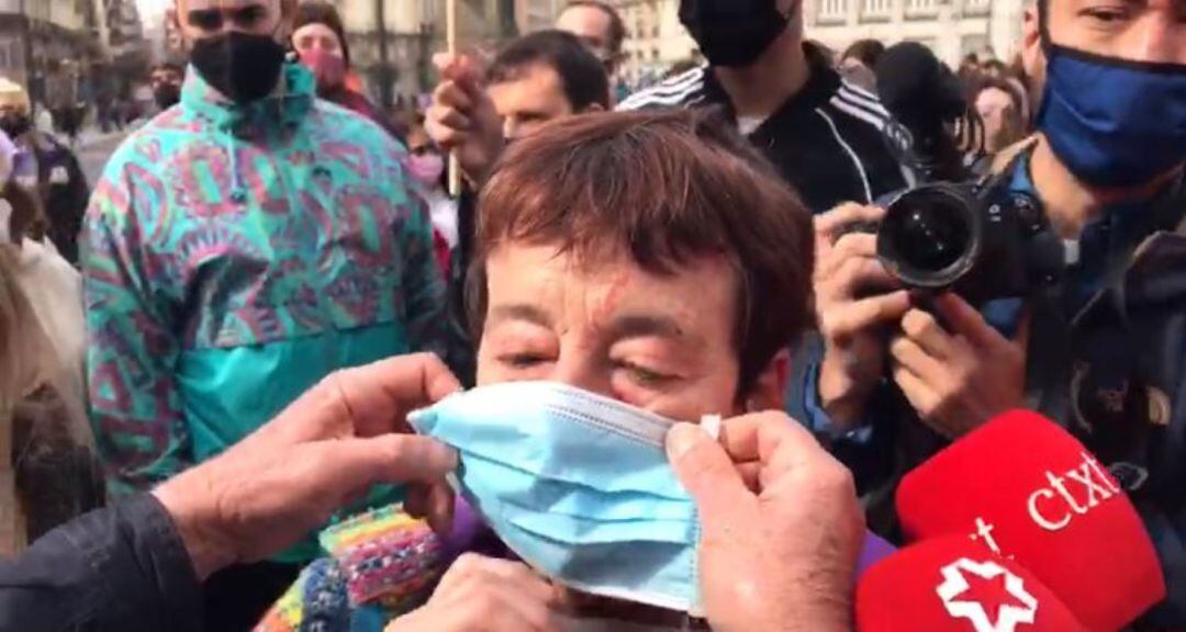 Arañazos en la cara de una mujer que participaba en una concentración no autorizada por el 8-M en la Puerta del Sol de Madrid. 