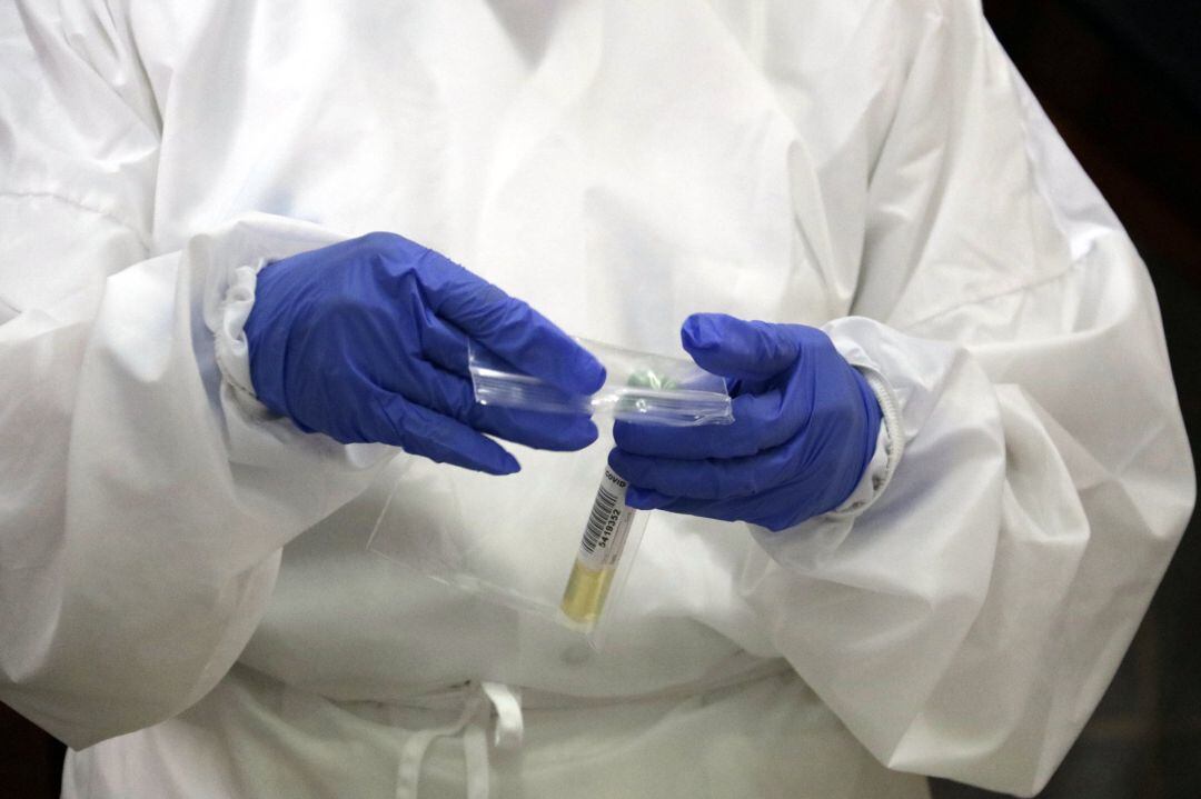 Muestras de pruebas PCR.