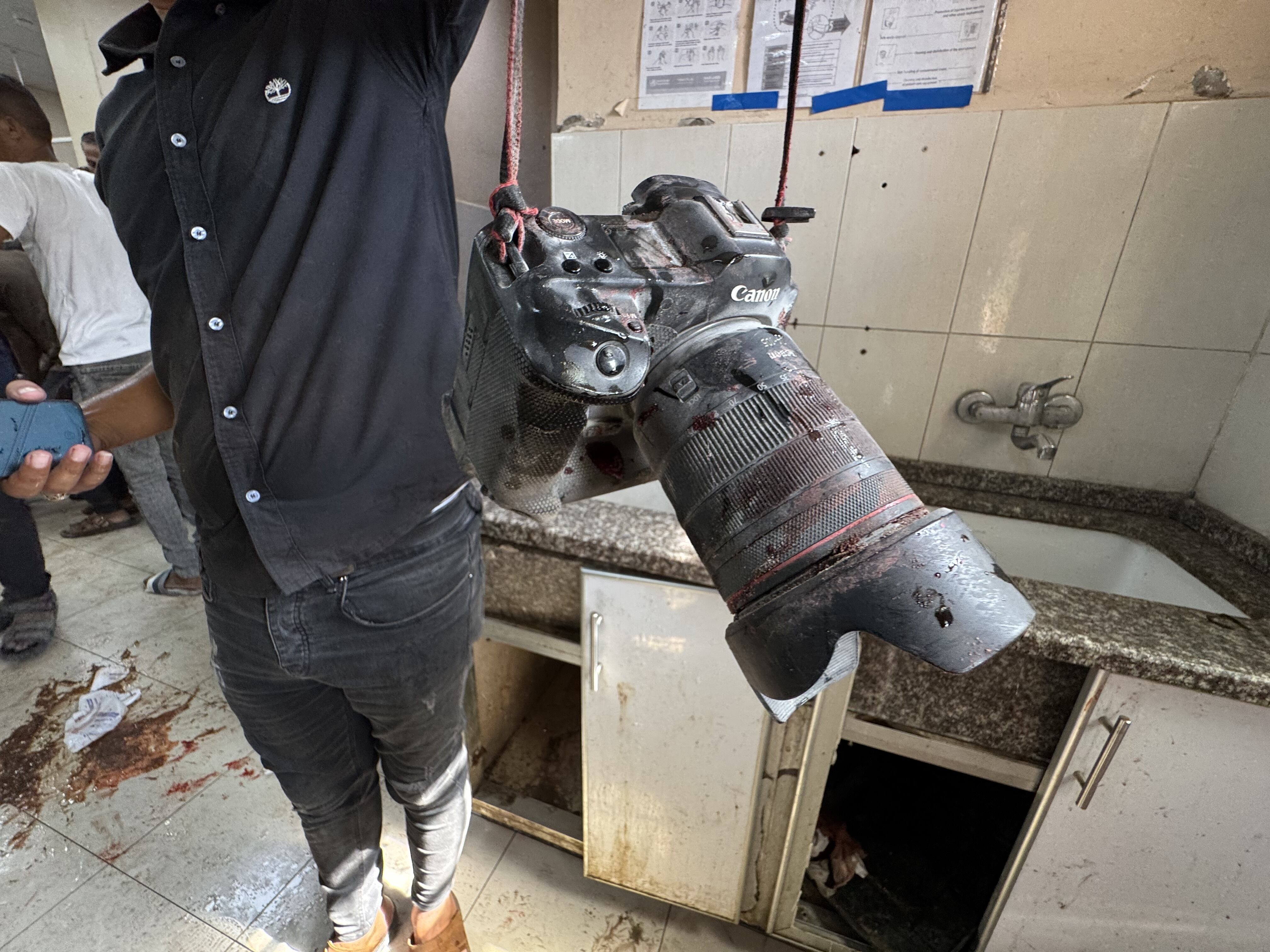 Imagen de una cámara dañada, manchada de sangre y polvo, tras los ataques israelíes contra el complejo médico Nasser en Jan Yunis, situado en el sur de la Franja de Gaza, el 25 de agosto de 2025.