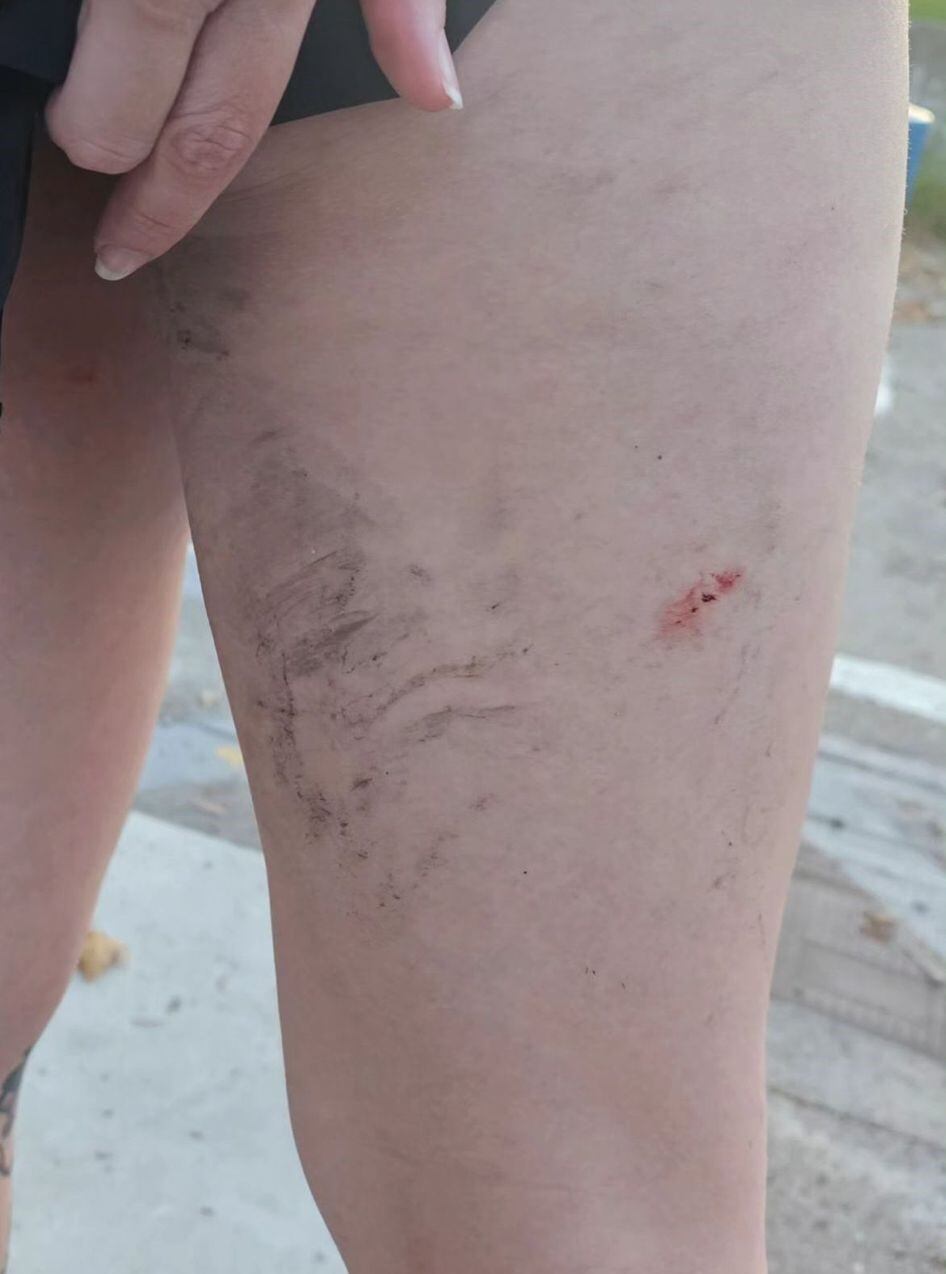 Imagen proporcionada por una de las víctimas, A.N.S.