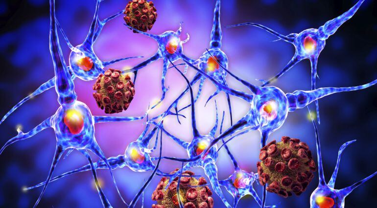 Una representació del virus de l'esclerosi múltiple