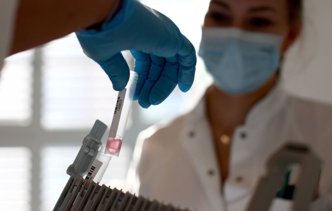 Muestras de PCR en un laboratorio. 