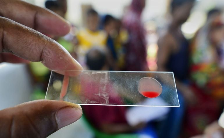 Un paciente recoge una muestra de su sangre en un campamento médico instalado en una población de la India.