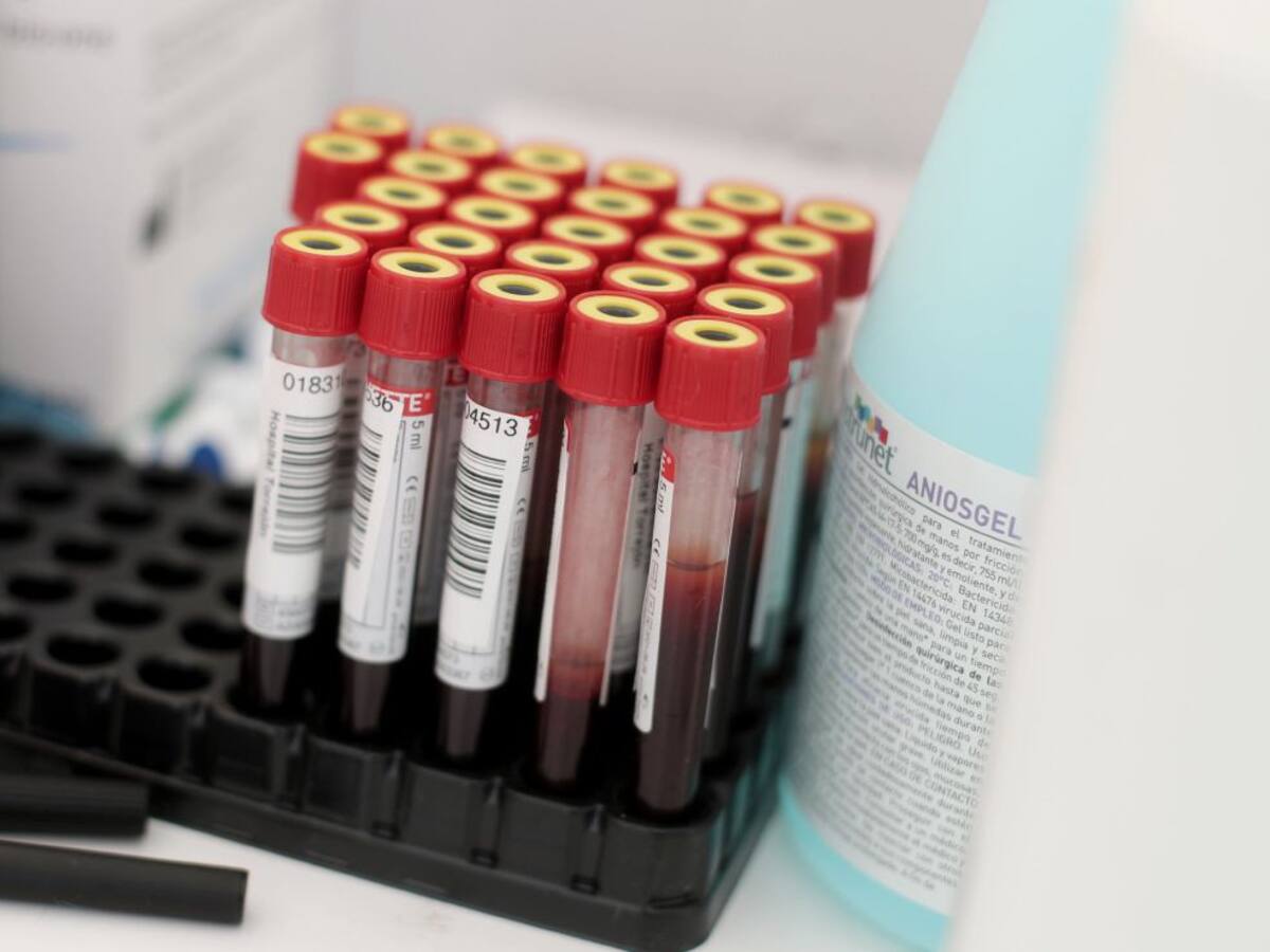 Tres jugadores del Linares dan positivo en los test de anticuerpos