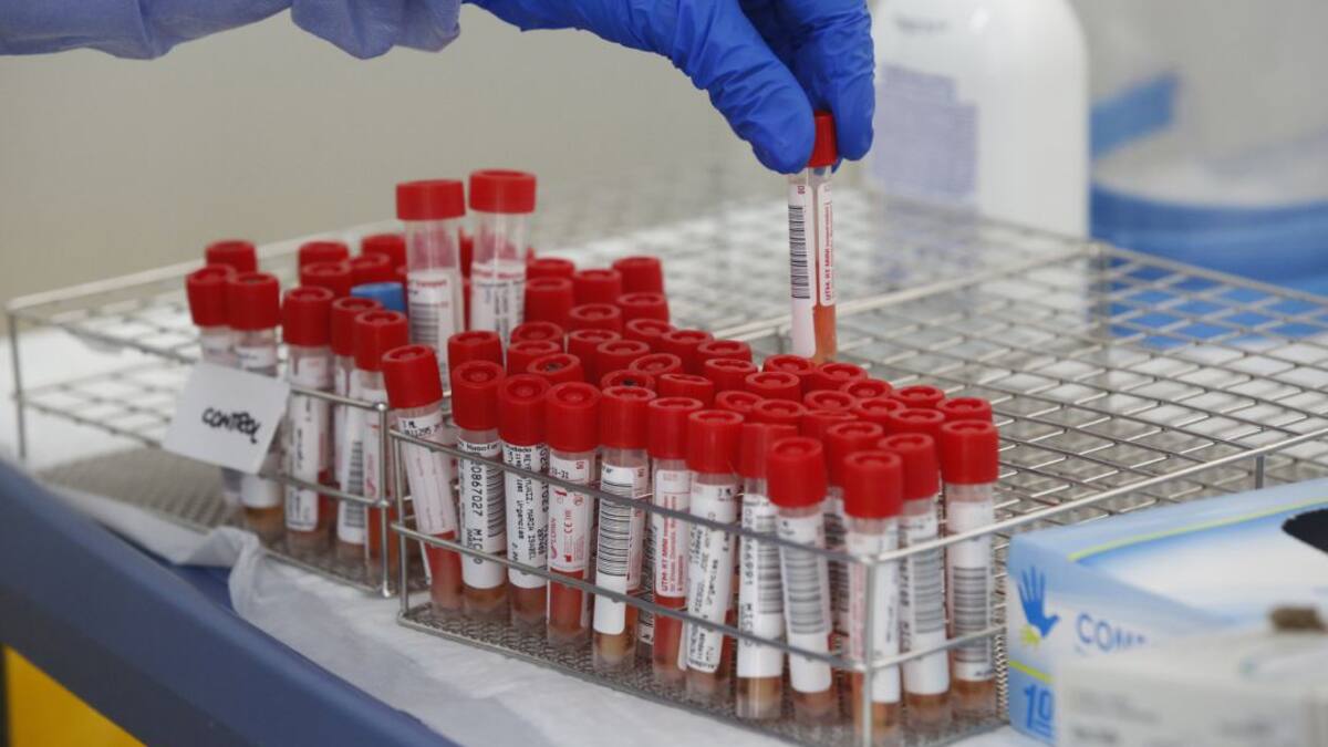 La situación de la pandemia del Covid en Balears retrocede a niveles de agosto