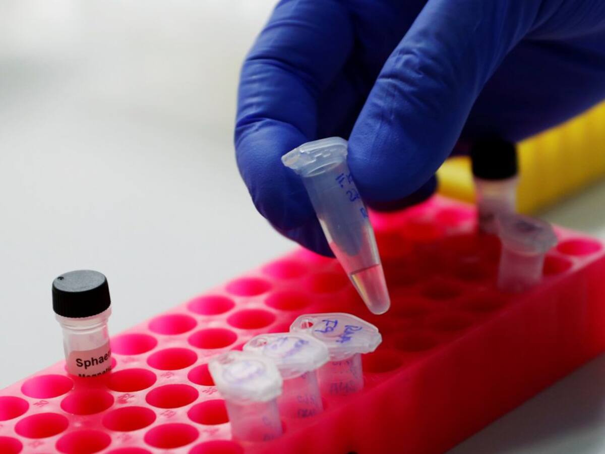 Asturias prosigue su escalada y notifica 435 nuevos casos, 10 fallecidos y 88 hospitalizaciones por COVID-19