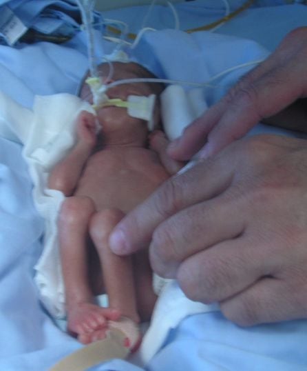 La mano de Juan Carlos junto al cuerpo de su hija Stella, al poco de nacer prematuramente