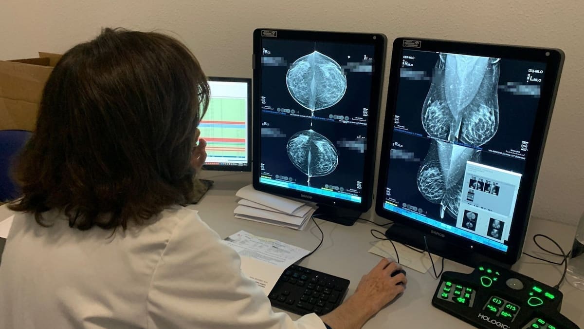 El SMS reduce los tiempos de espera en Sanidad respecto a hace un año, pero aumentan en cuanto a junio