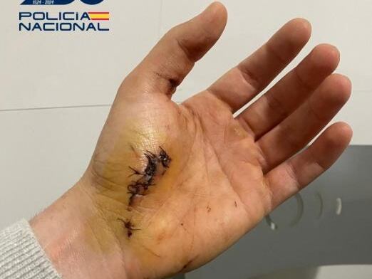 MELILLA, 27/03/2025.- Un policía nacional destinado en Melilla ha evitado en Málaga una agresión de violencia machista en la vía pública gracias a una intervención cuando se encontraba libre de servicio en la que resultó herido por la fuerte resistencia del presunto agresor, que fue detenido. EFE/ Policía Nacional SOLO USO EDITORIAL/SOLO DISPONIBLE PARA ILUSTRAR LA NOTICIA QUE ACOMPAÑA (CRÉDITO OBLIGATORIO)