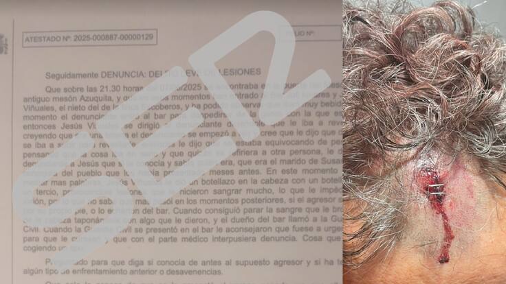 Palabras en la SER del agredido en Sierra de Fuentes