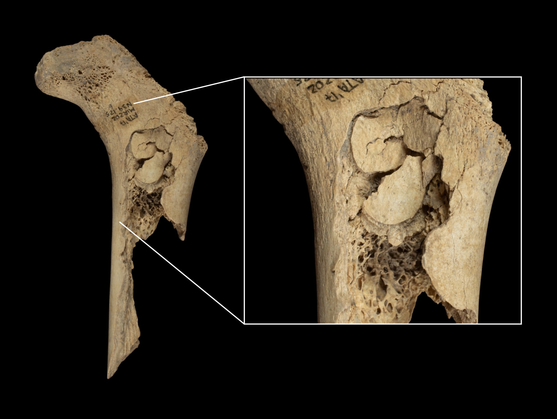 Fémur humano infantil encontrado en El Mirador, con marcas de percusión para extracción de médula