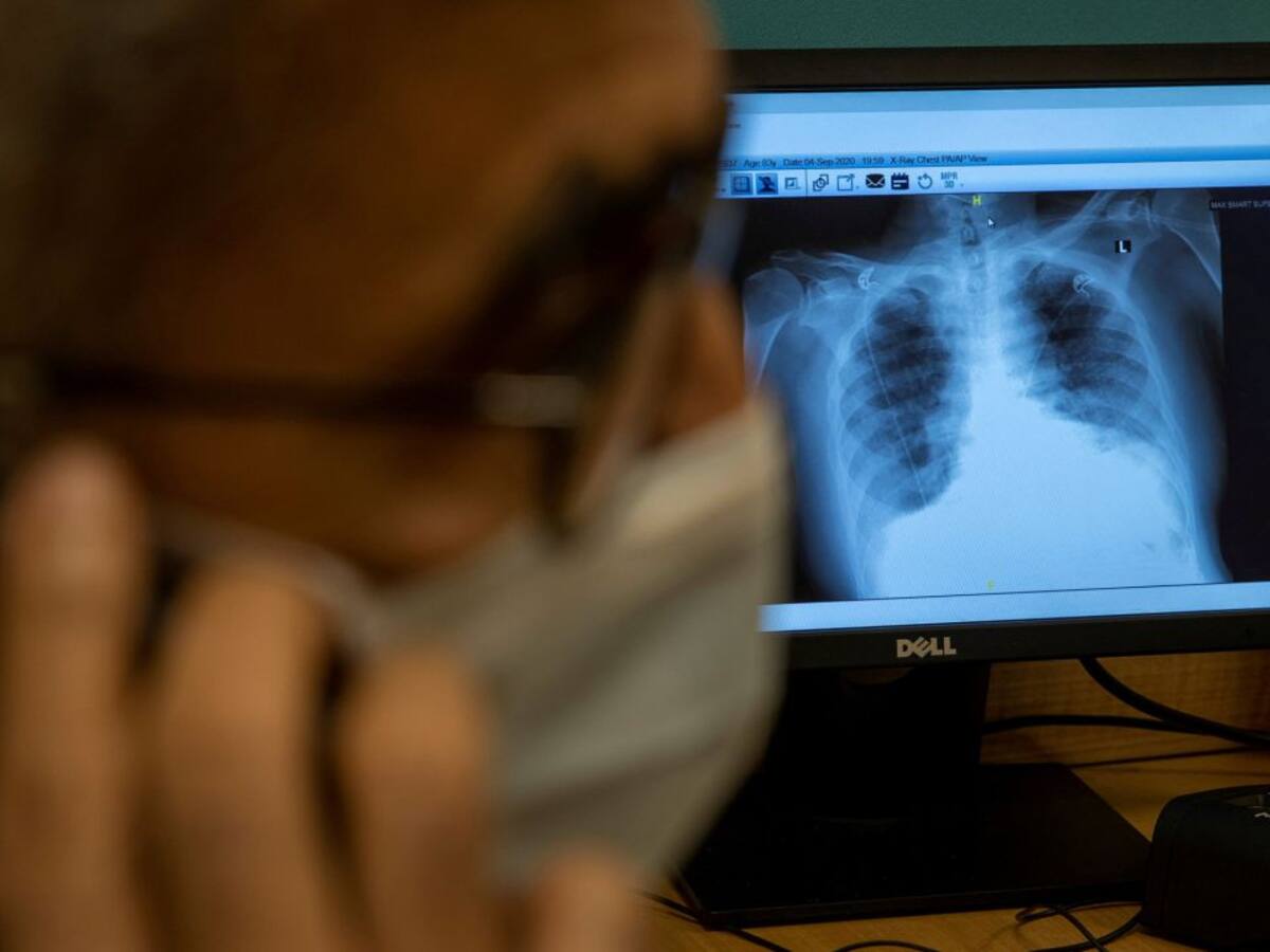 Así está la tasa PCR de coronavirus en la provincia de Cádiz