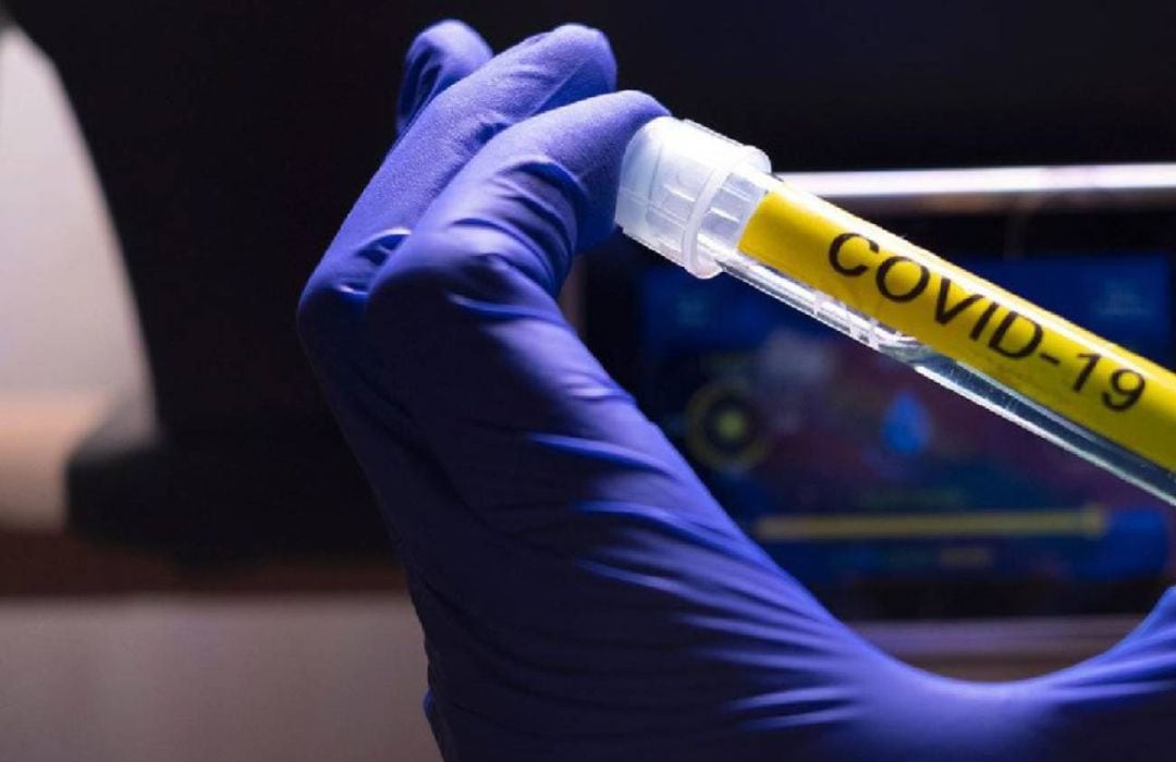 Vial con muestra de Covid-19