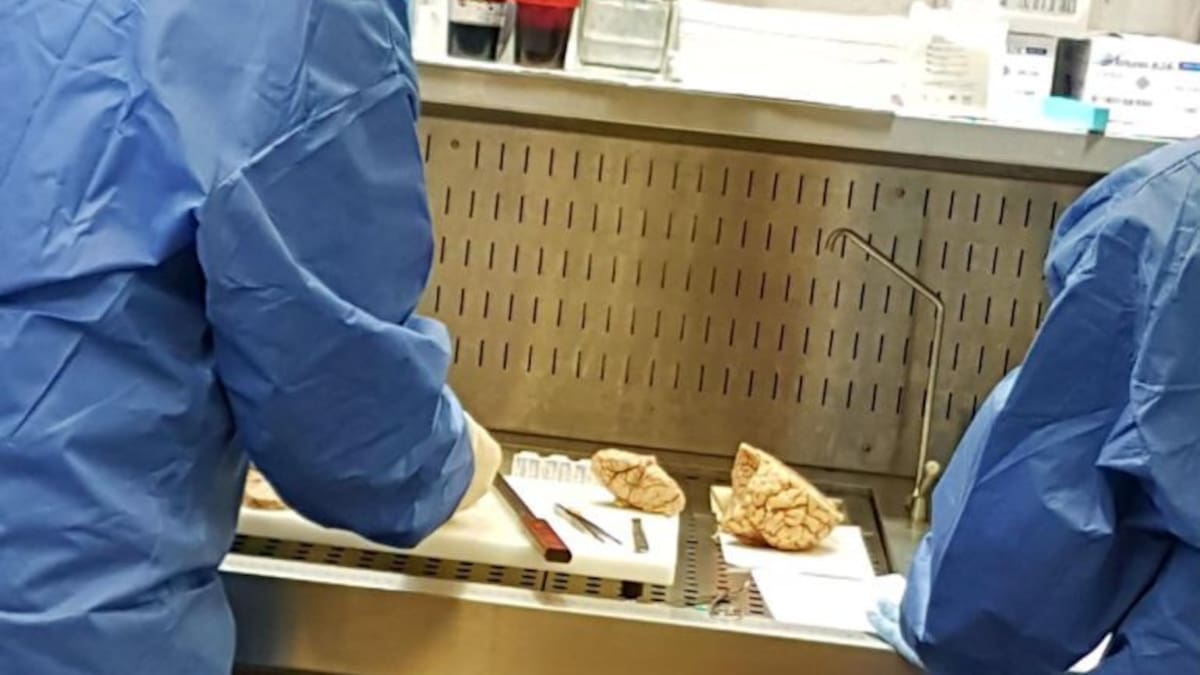 El neurólogo Cristian Alcahut, premiado por su investigación sobre el diagnóstico del alzhéimer