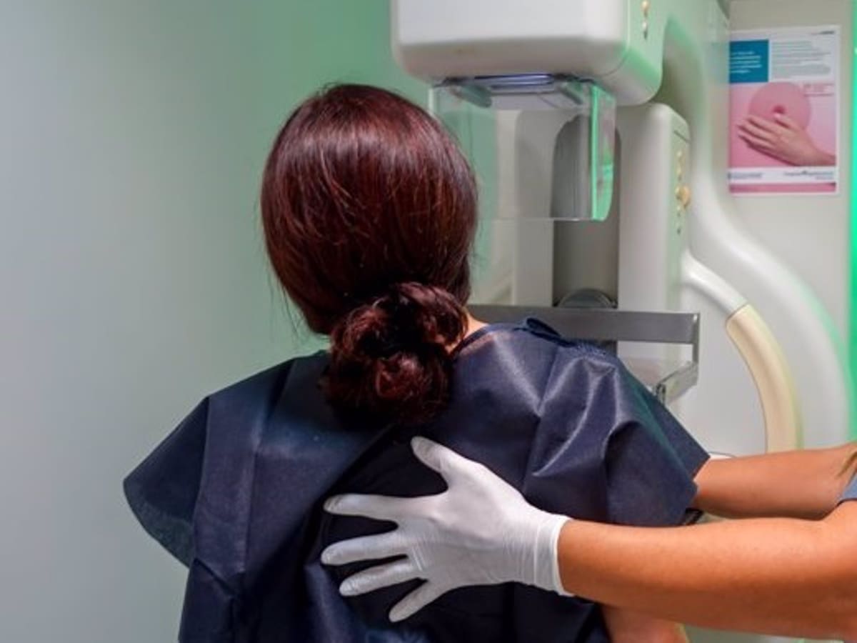 Las mamografías en España funcionan: la radiografía por Comunidades Autónomas