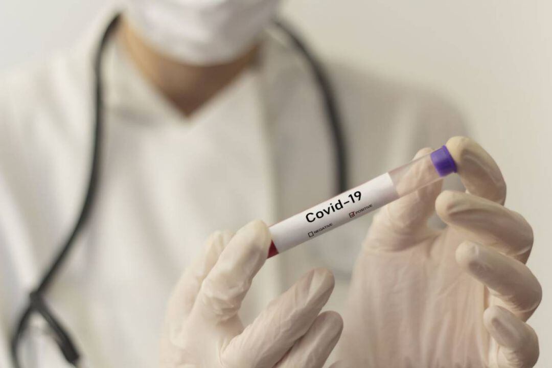 Muestra de sangre para un test de Covid-1)