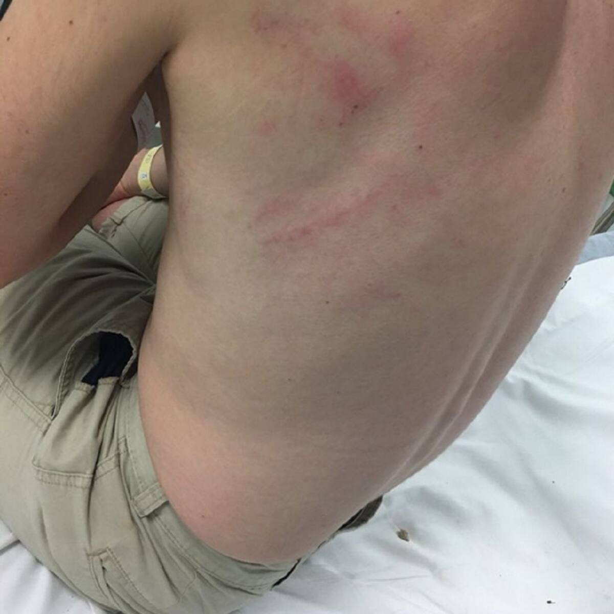 Agresión homófoba de los porteros de una discoteca de San Javier